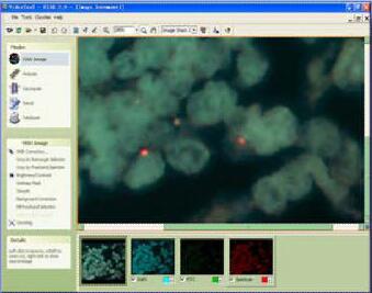 美国NVT荧光原位杂交FISH分析系统