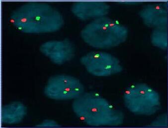 美国NVT荧光原位杂交FISH成像分析系统